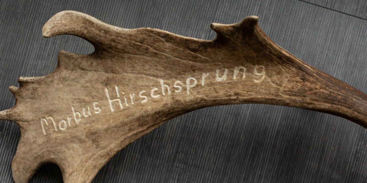 hirschsprung